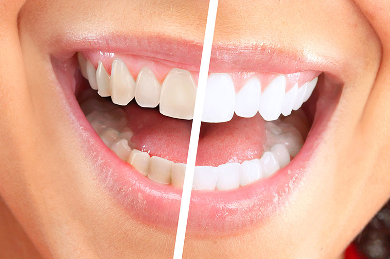 Services Cosmetic Dentistry