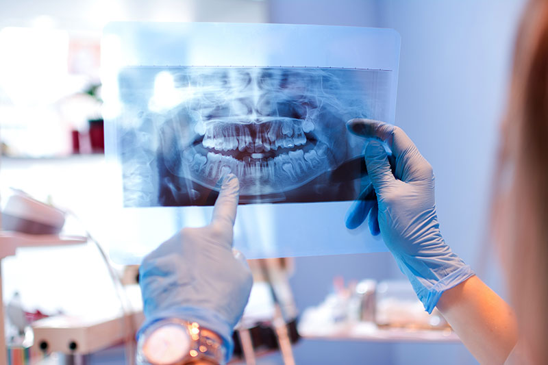 Services Oral Surgery