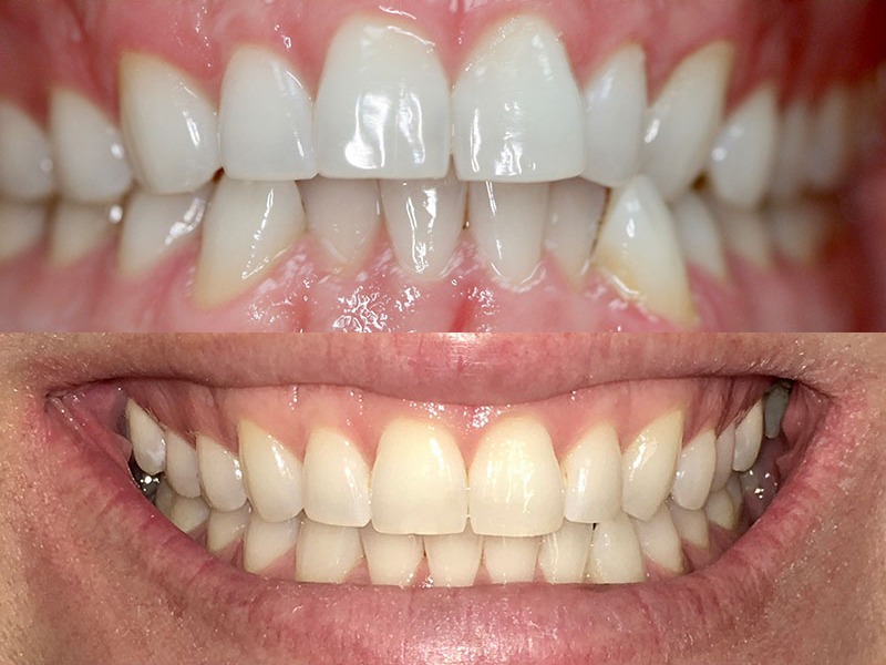 Before and After Case 7